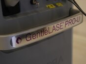 "Alexandrite Candela PRO U" lazer aparatı