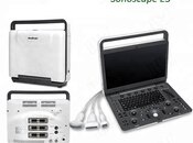 "Sonoscape E3" USM cihazı 